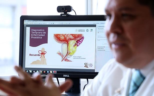 IMSS recomiendan revisiones periódicas para una adecuada salud prostática