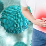 Brote de norovirus golpea crucero en Bahamas